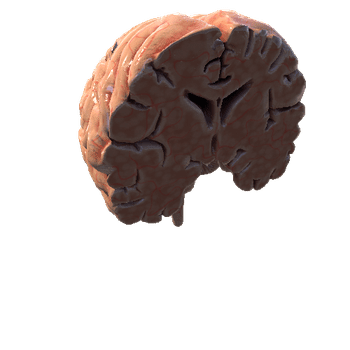 HumanBrainCross_Frontal Plane